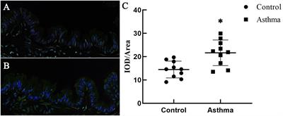 The Degradation of Airway Epithelial Tight Junctions in Asthma Under High Airway Pressure Is Probably Mediated by Piezo-1